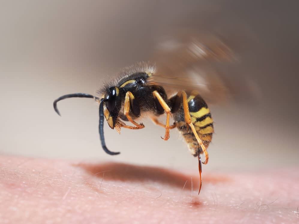 Wasp sting