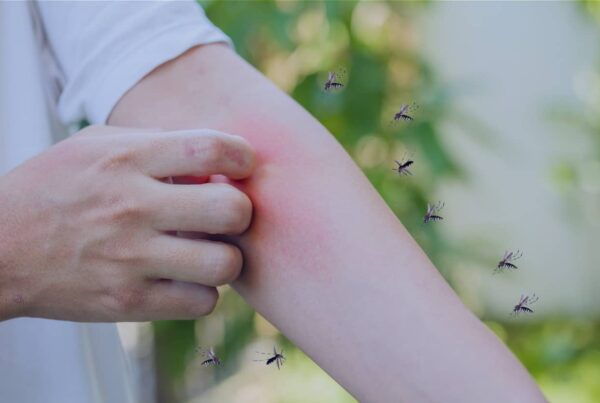 How to Get Rid of Mosquitoes in Your Backyard the Right Way