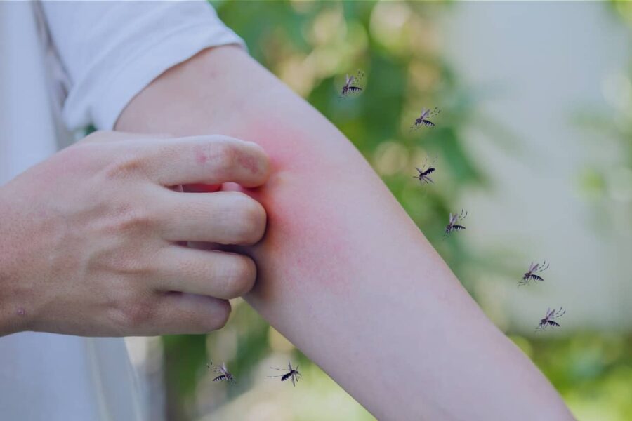 How to Get Rid of Mosquitoes in Your Backyard the Right Way