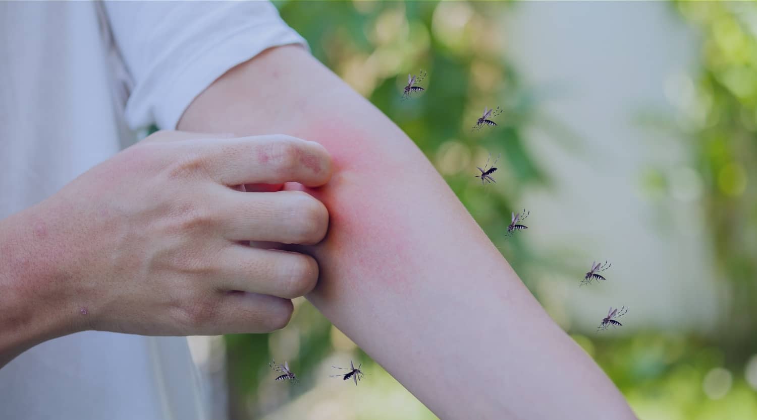 How to Get Rid of Mosquitoes in Your Backyard the Right Way